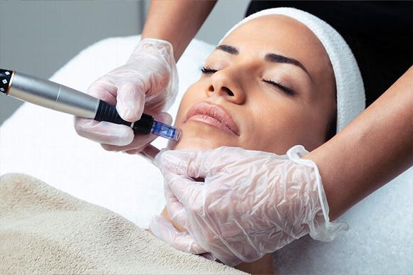 Mesotherapy needs near ladies chin